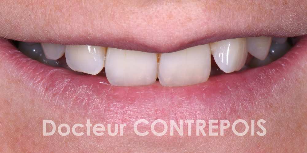 Docteur Contrepoix Dentiste Bordeaux