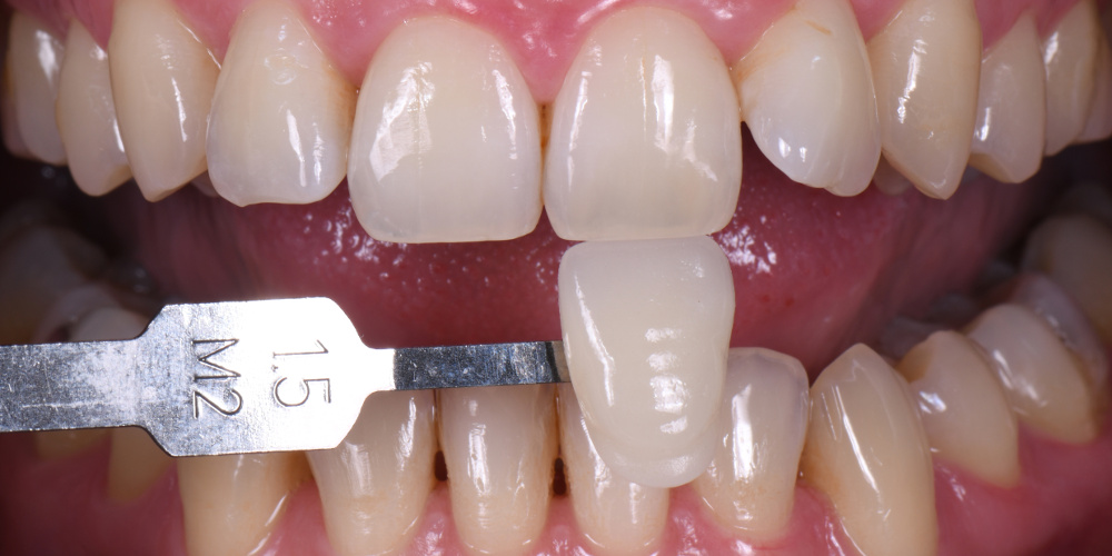 Dentiste à Bordeaux sur rendez-vous