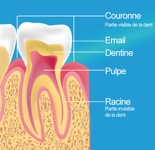 Dévitalisation-Traitement endodontique Bordeaux