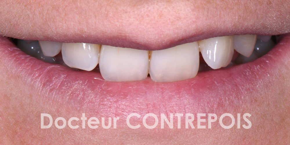 Docteur Contrepoix Dentiste Bordeaux 