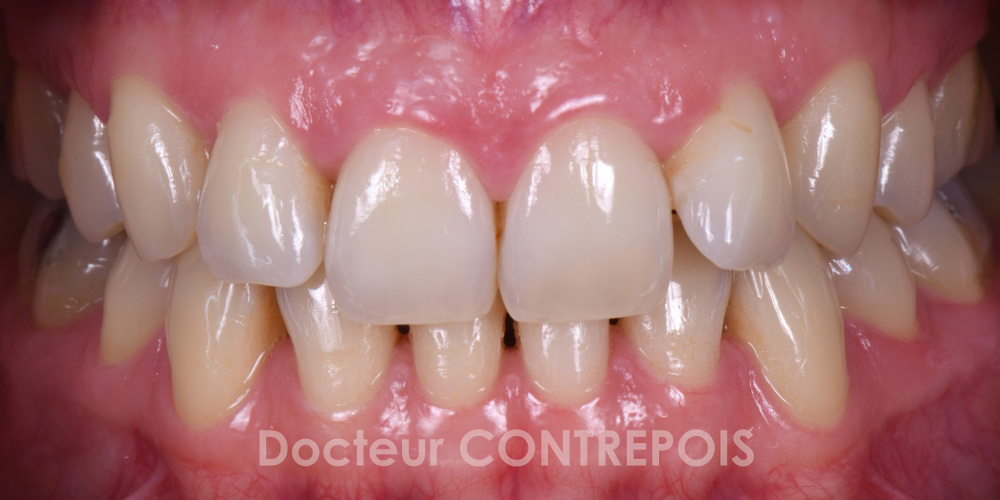 Dentiste Contrepoix vous reçoit à Bordeaux 